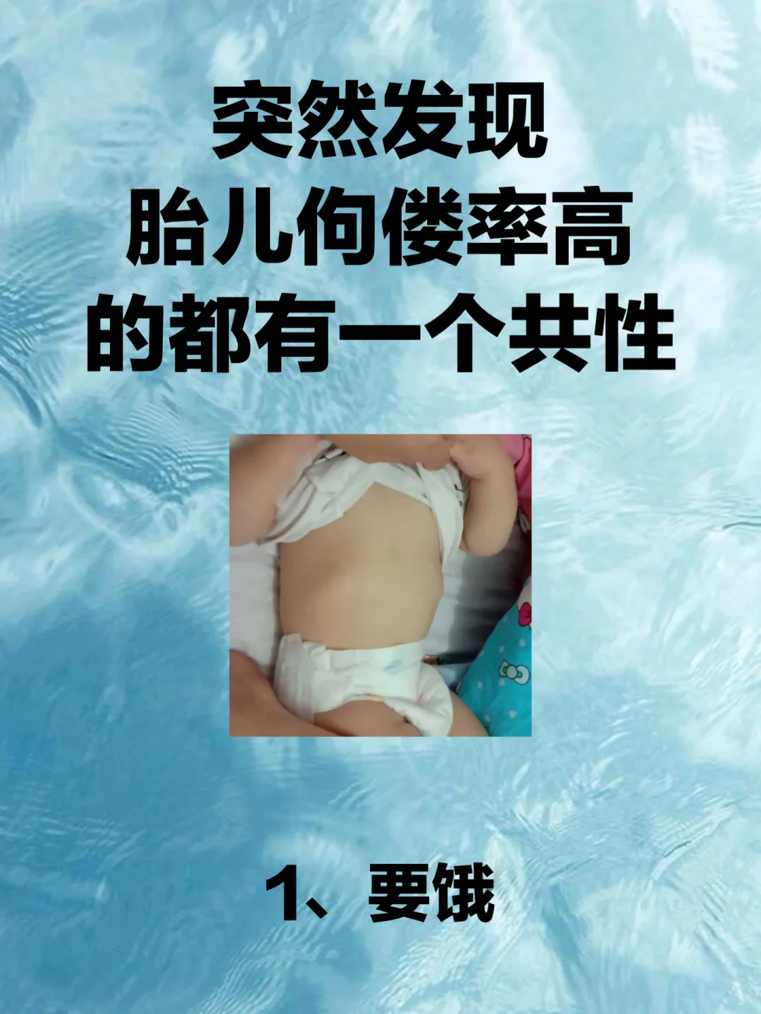 孕妈警惕！！！胎儿佝偻率高的都有共性！！,国内正规代生医院-国内咨询代怀公司