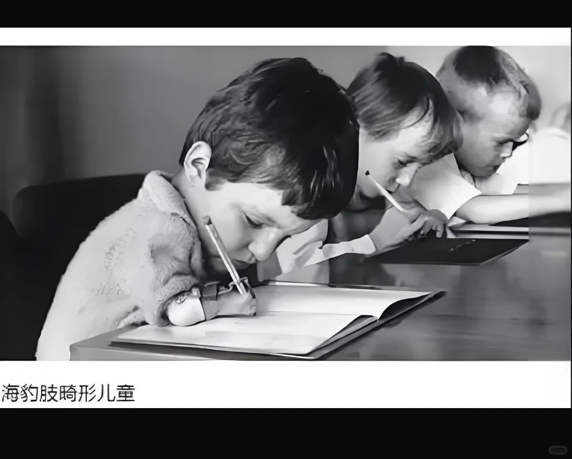 人类历史的惨痛教训-反应停胎儿致畸案,代孕怎么保证成功率